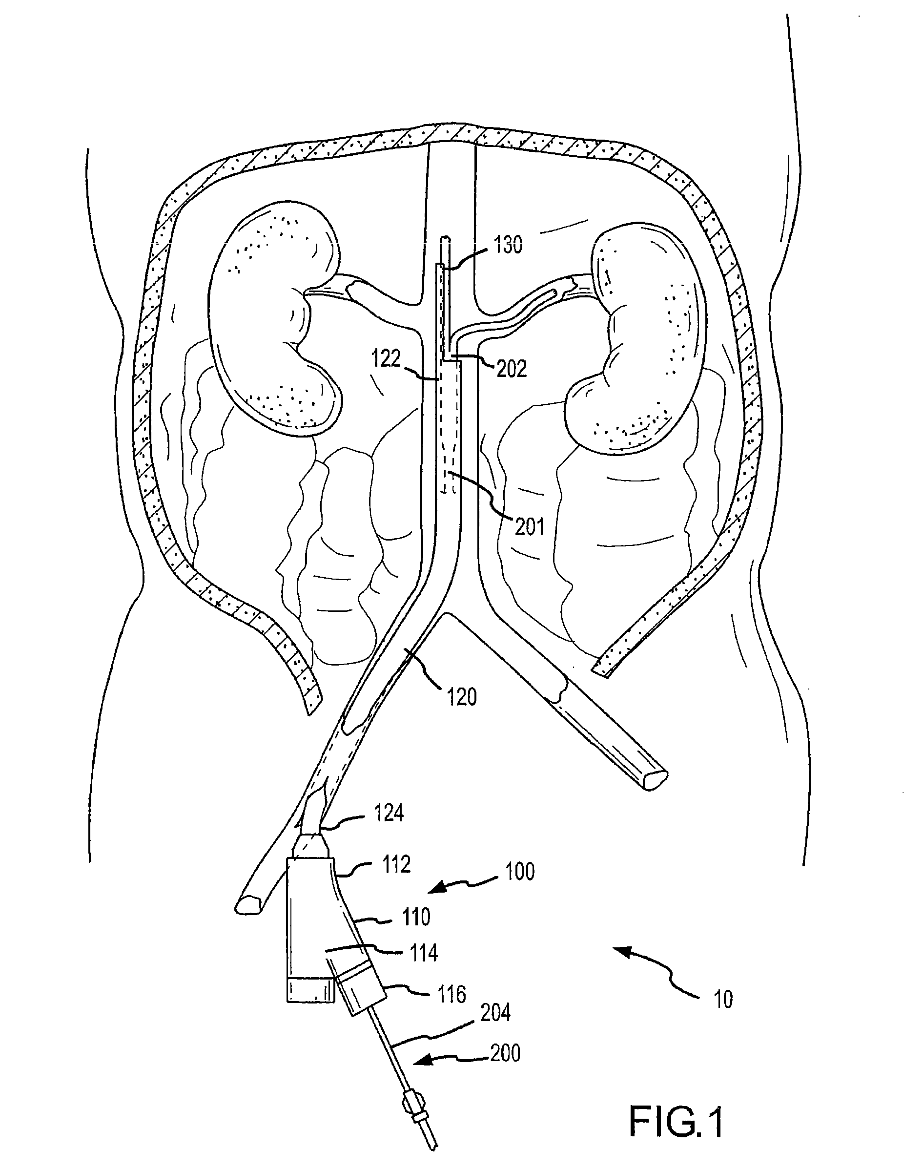 Selective renal cannulation and infusion systems and methods