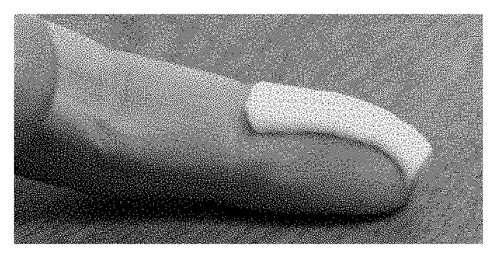 Topical phenytoin for use in the treatment of peripheral neuropathic pain