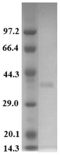 L-asparaginase XiDL and coding gene and application thereof