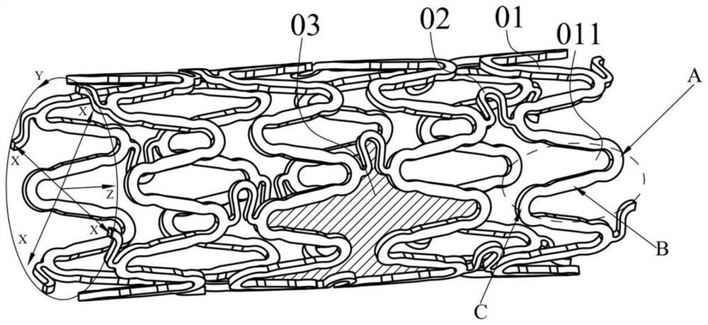 Absorbable stent