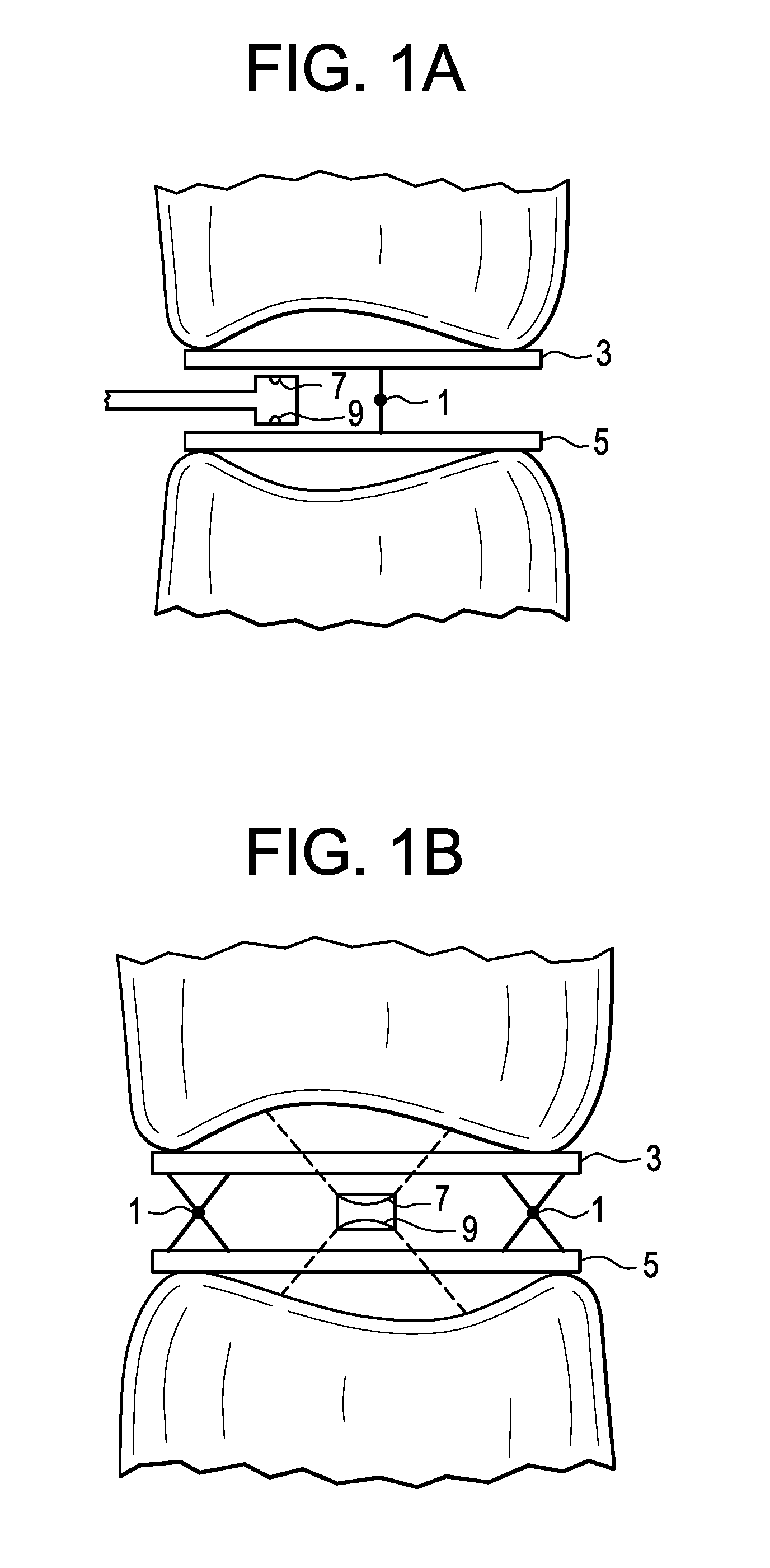 Patient-Specific Spinal Fusion Cage and Methods of Making Same