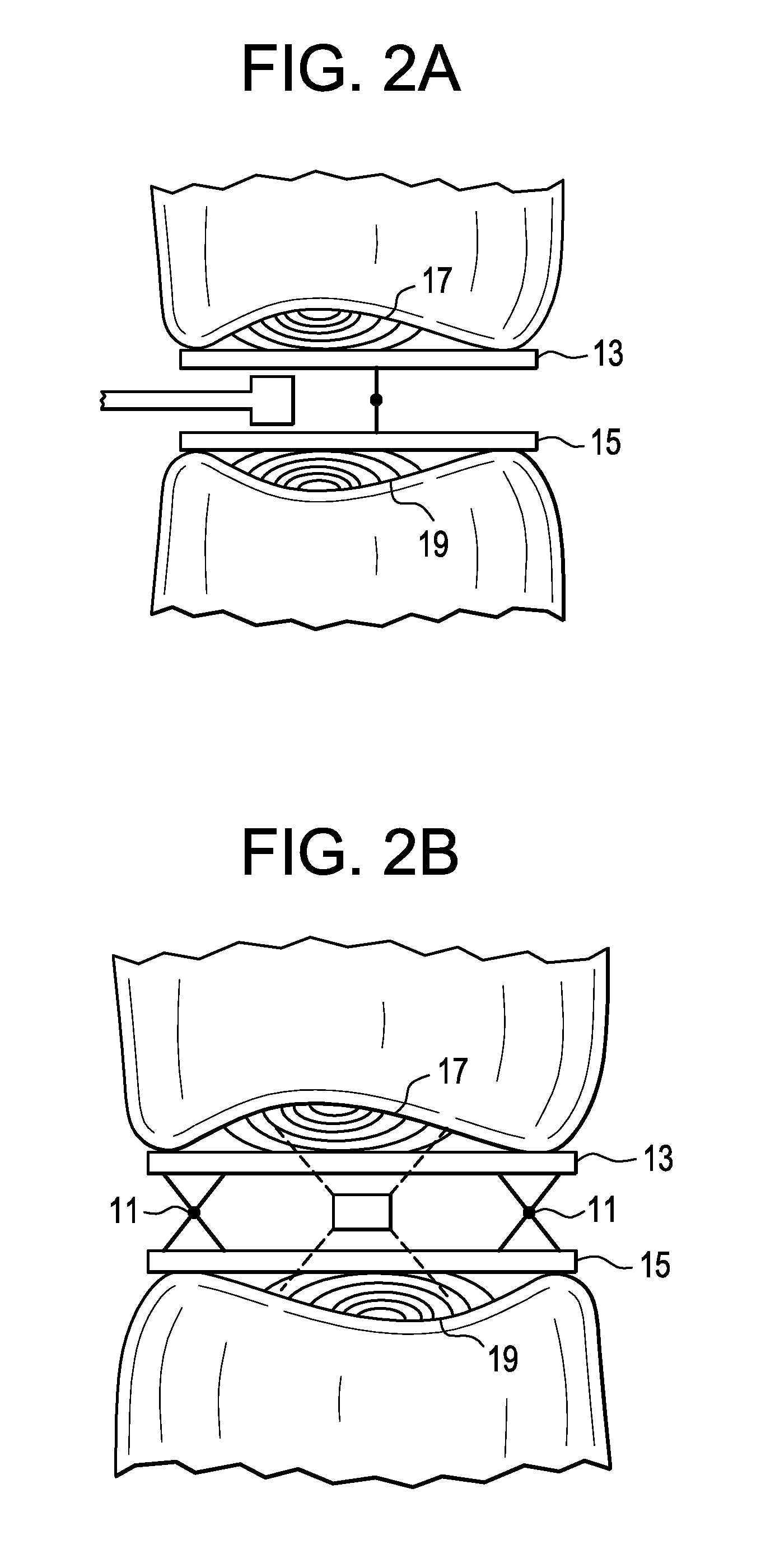 Patient-Specific Spinal Fusion Cage and Methods of Making Same