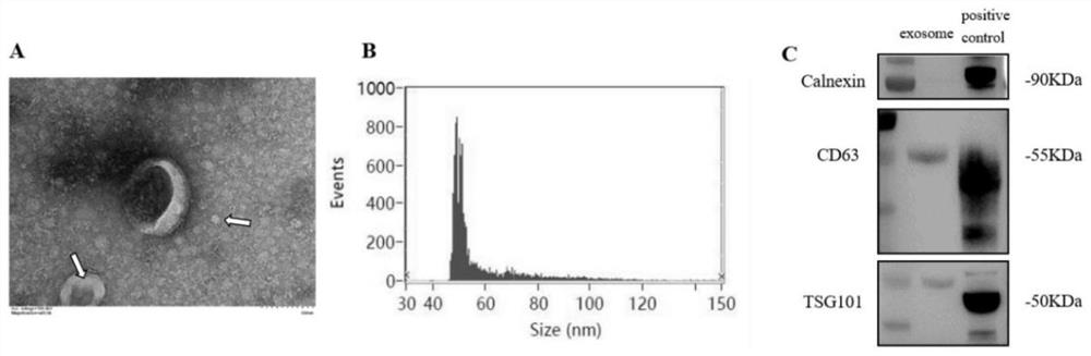 Application of plasma exosome in development of medicine for treating AAAD with lung injury