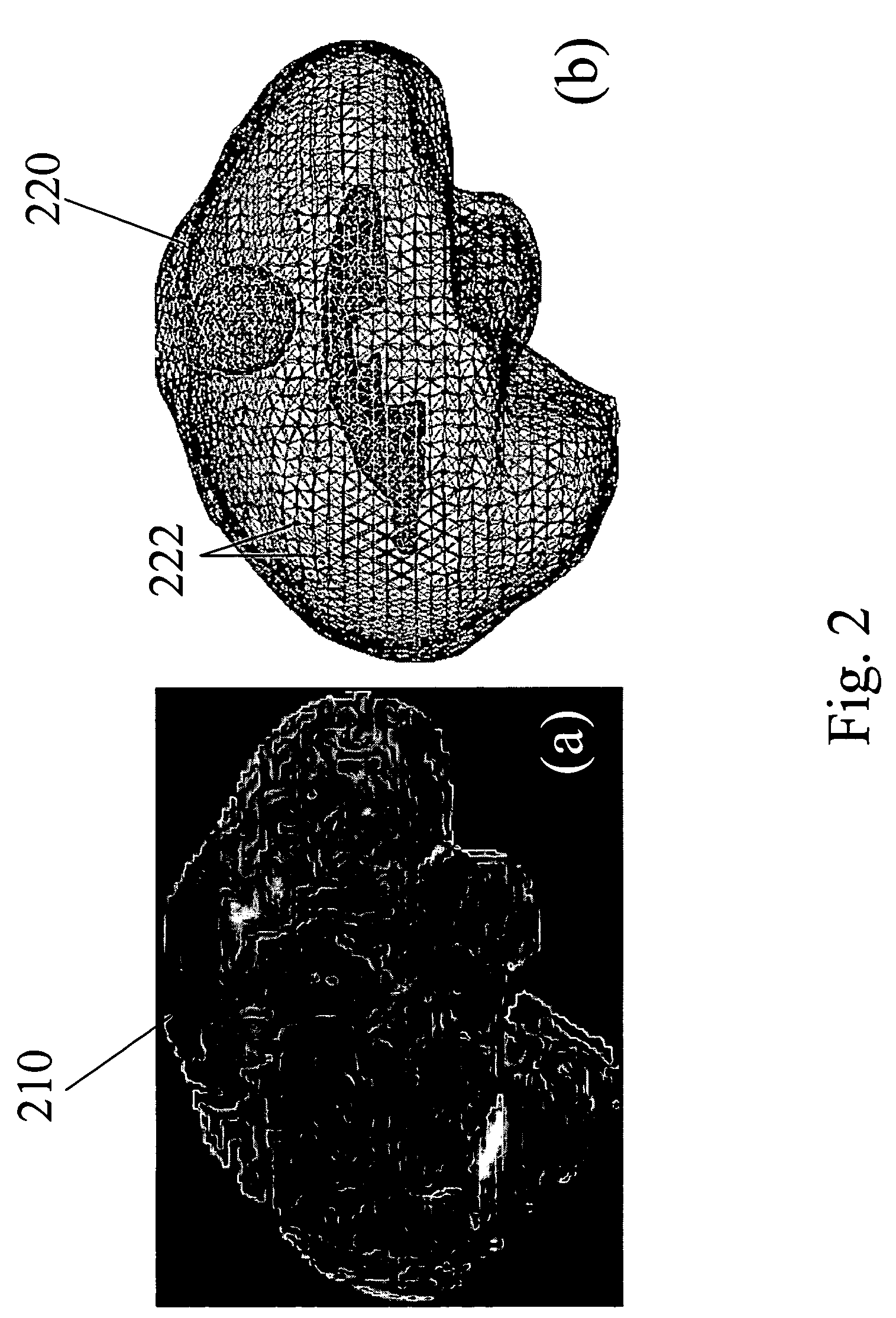 Apparatus and methods of brain shift compensation and applications of the same