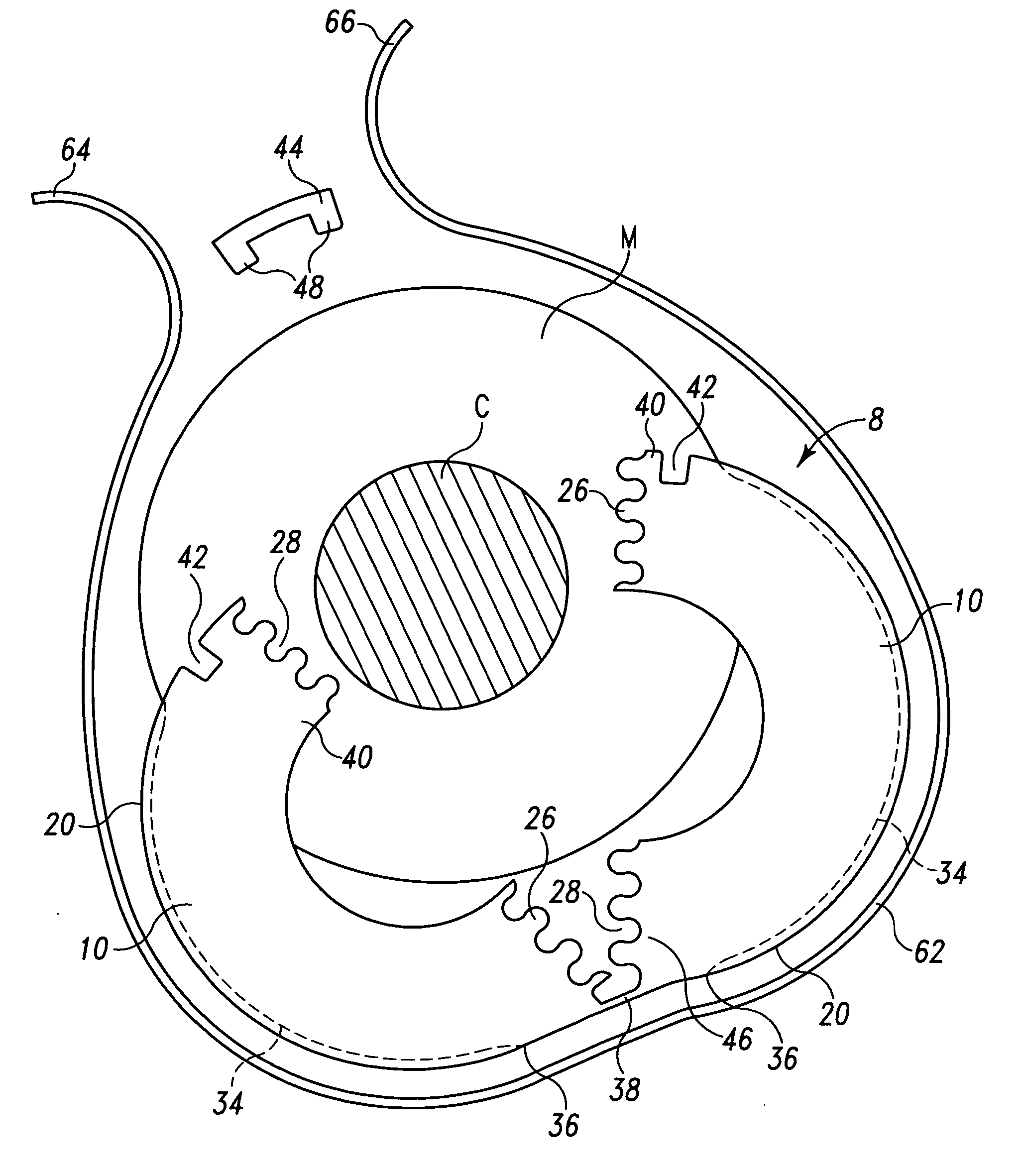 Molded washer assembly