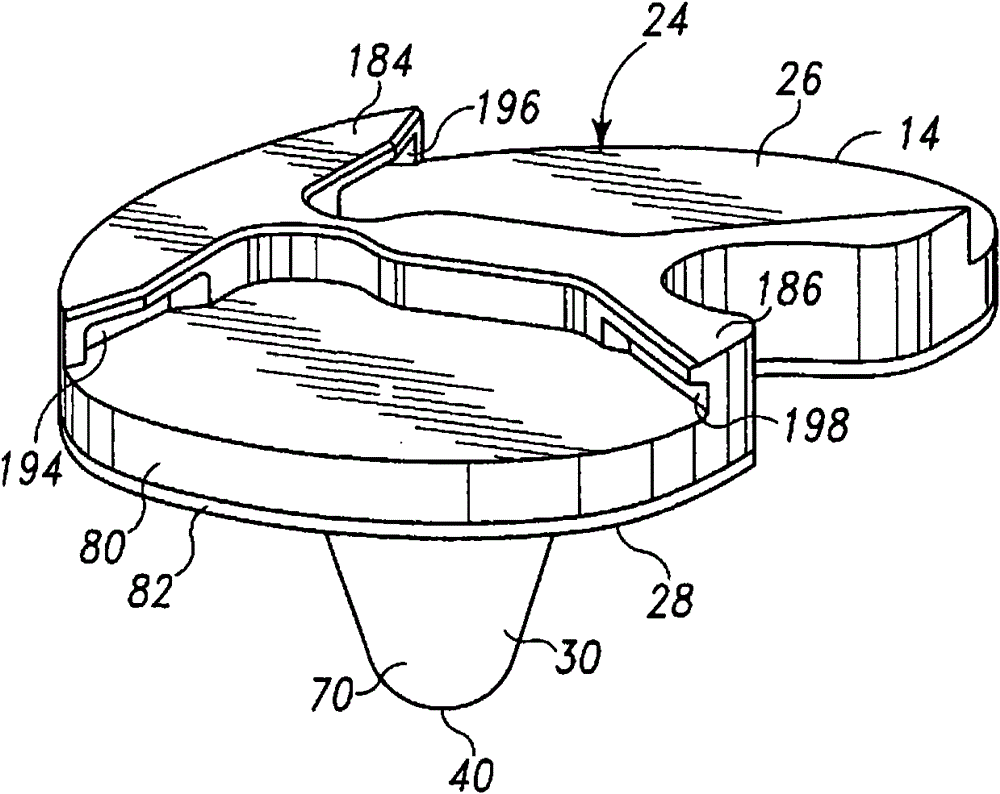 Prosthesis for bone cementless fixation and its preparation method