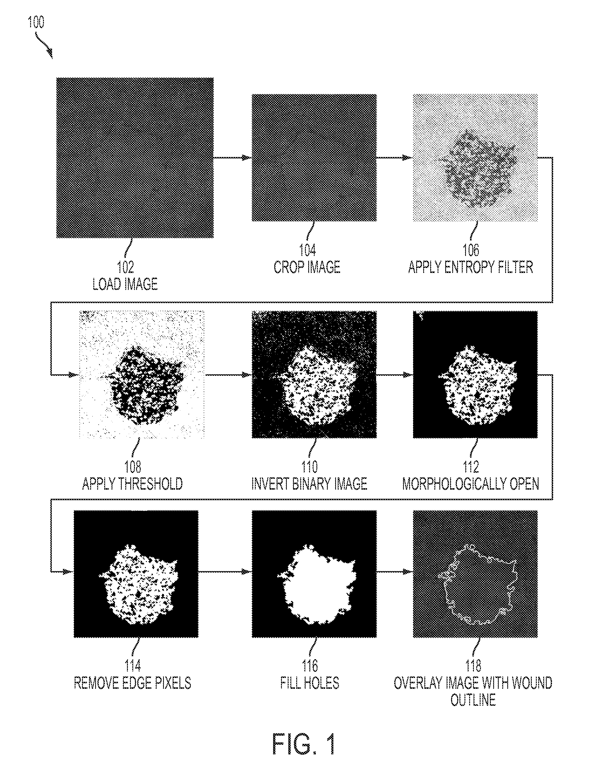 Quantitative image analysis for wound healing assay