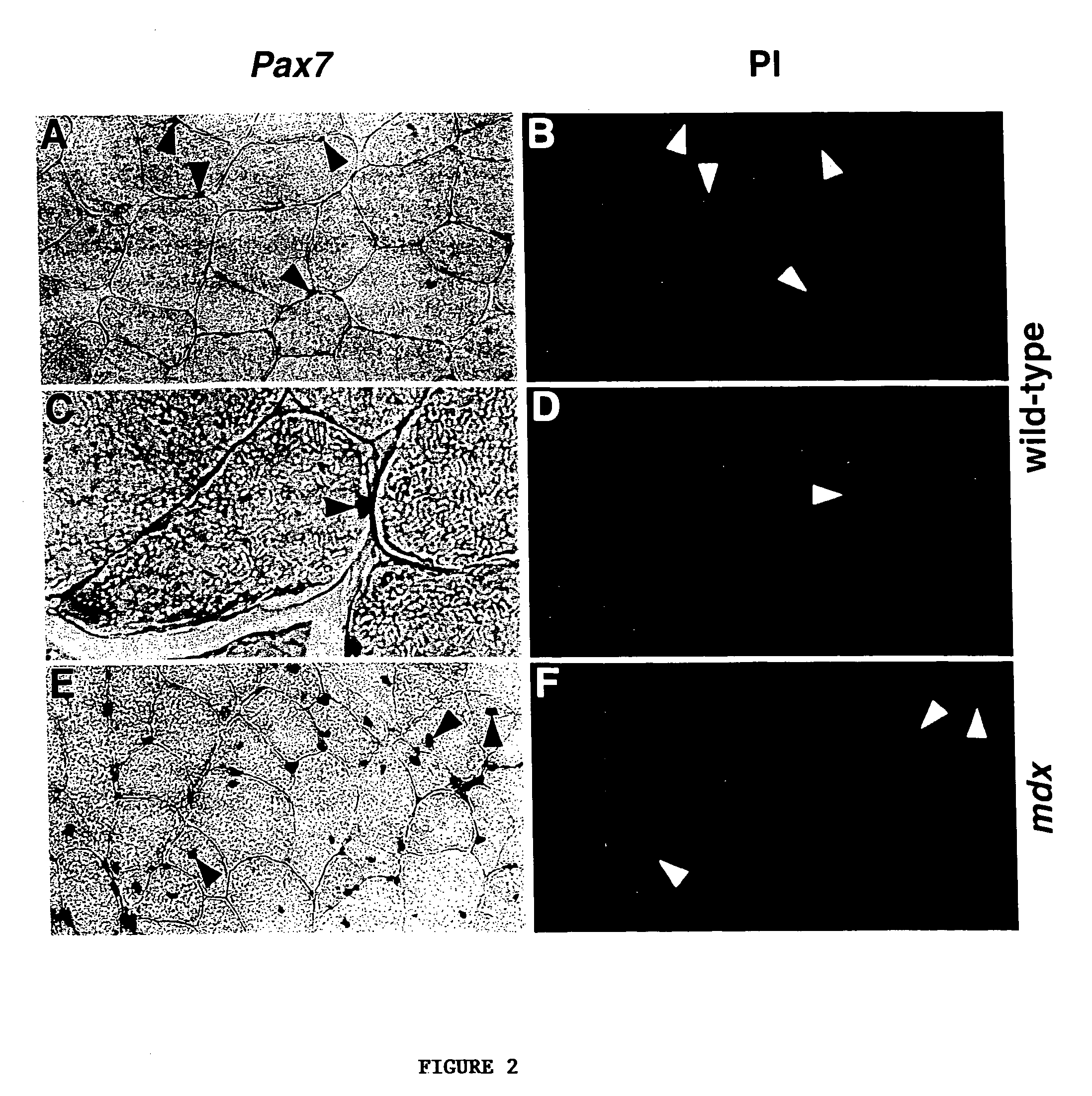 Pax-encoding vector and use thereof