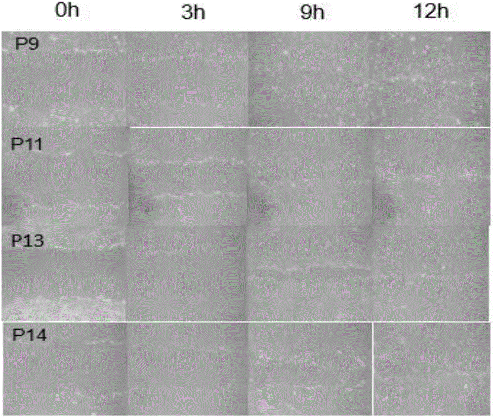 Method for promoting function and characteristic of corneal endothelial cells