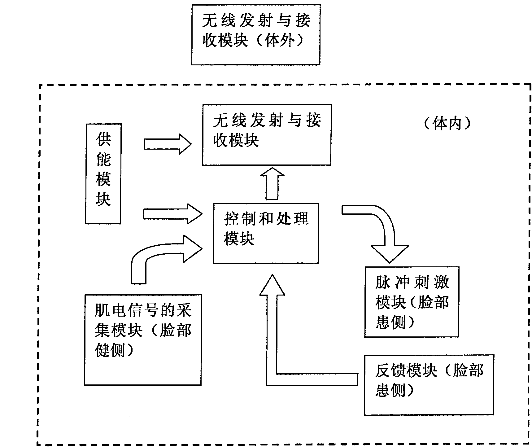 Artificial facial nerve prosthesis with facial nerve substituting function