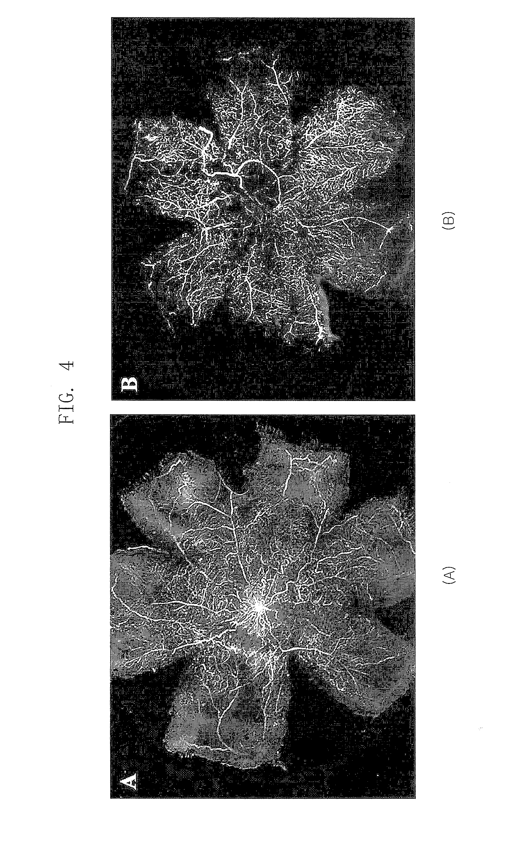 Composition for Treating Retinopathy or Glaucoma Comprising Thrombin Derived Peptides