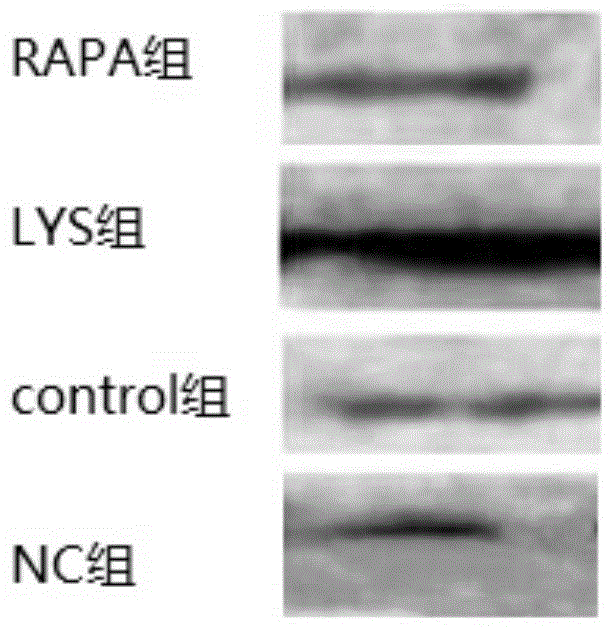 Application of chlorogenic acid to preparing medicine for treating Hutchinson-Gilford syndrome