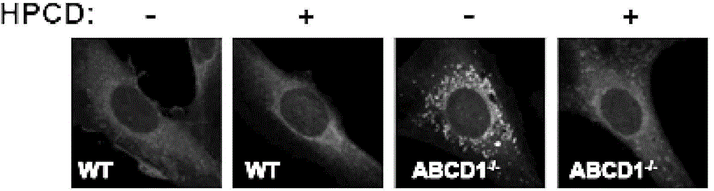 Application of 2-hydroxypropyl-beta-cyclodextrin to the preparation of drug for treatment of X-linked adrenoleukodystrophy