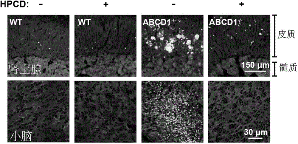 Application of 2-hydroxypropyl-beta-cyclodextrin to the preparation of drug for treatment of X-linked adrenoleukodystrophy