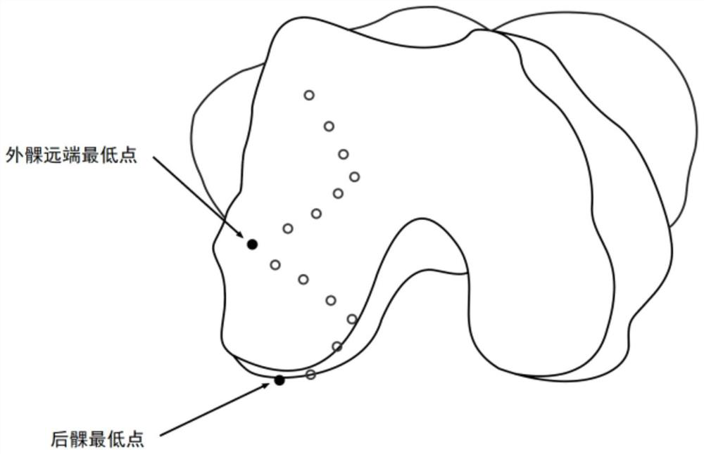 Intraoperative prosthesis recommendation method and system for knee joint surgical navigation system