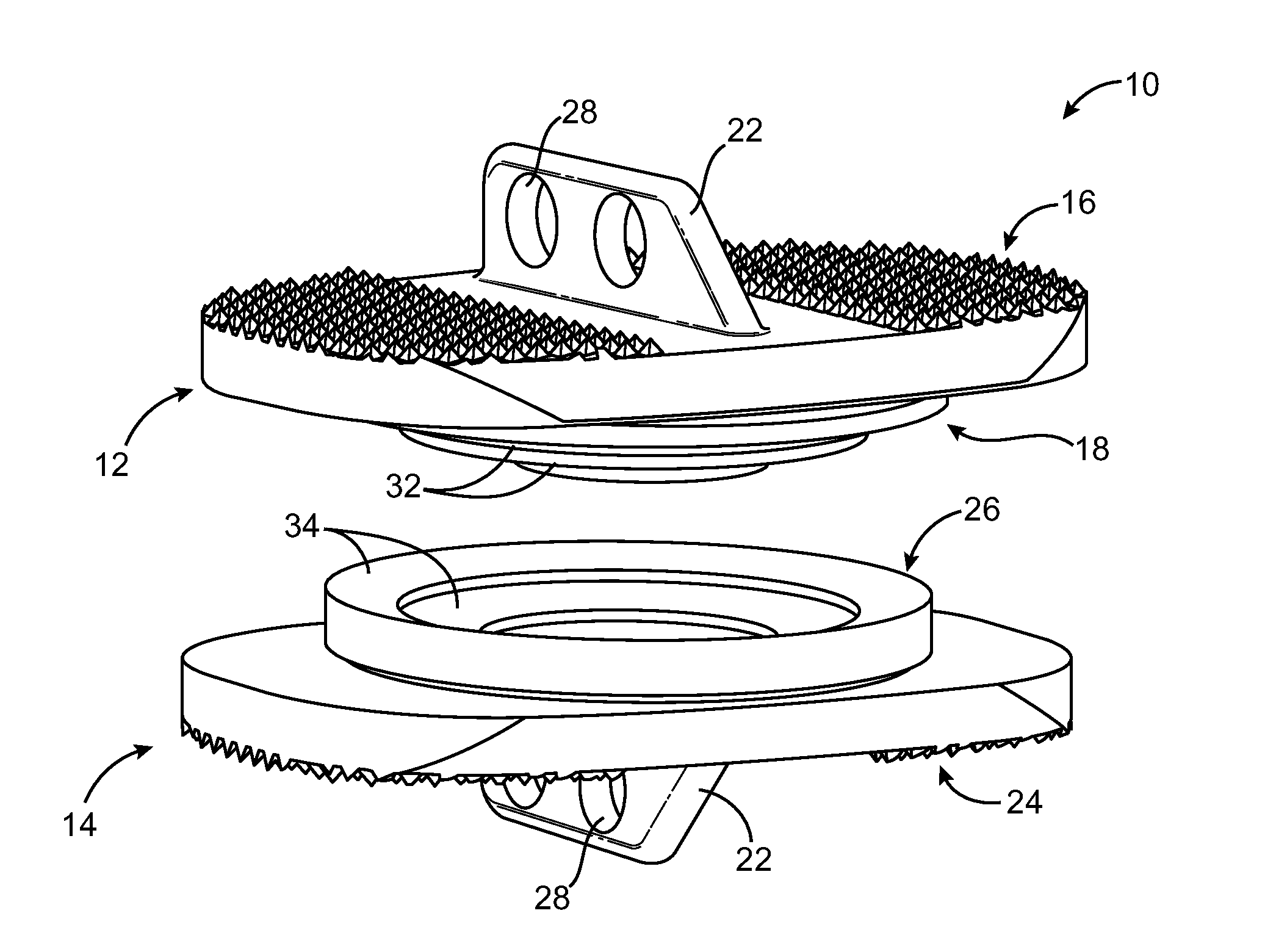 Limited Motion Prosthetic Intervertebral Disc