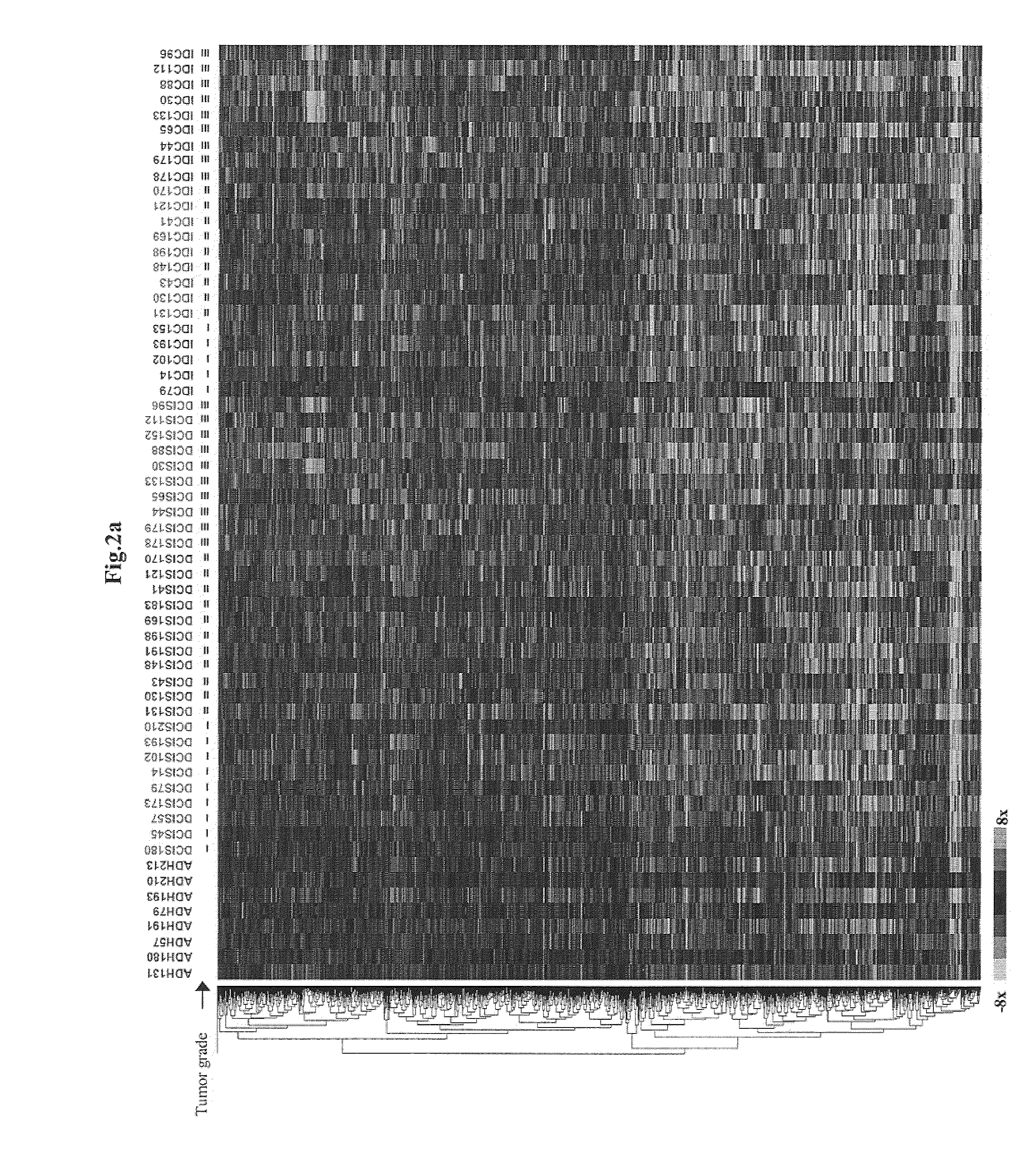 Grading of breast cancer