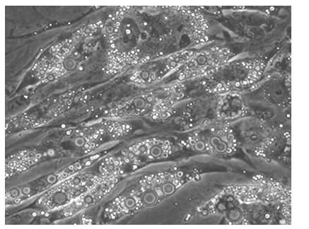 Stem cell repairing material as well as preparation method and application thereof