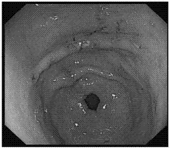 Medicament for treating gastrointestinal dysfunction and preparation method thereof