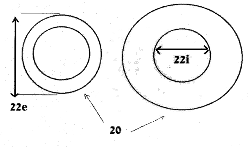 Single-ring cardiac valve support