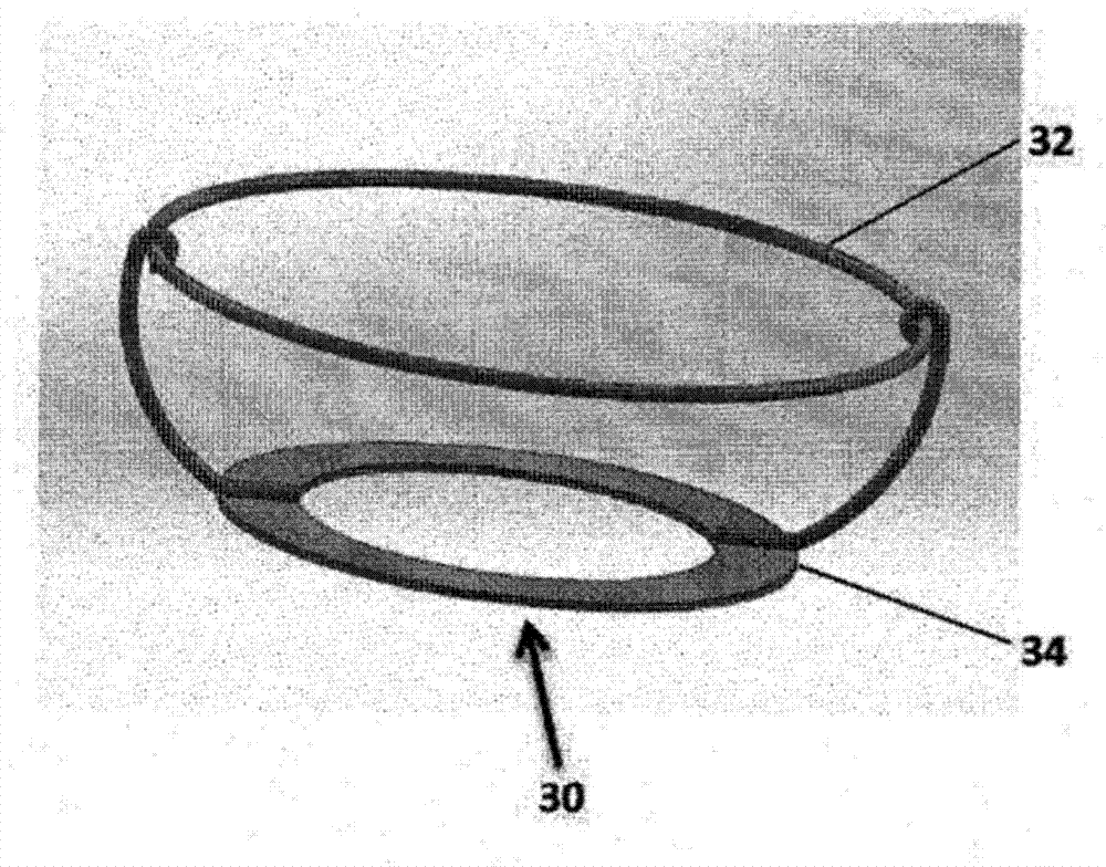 Single-ring cardiac valve support