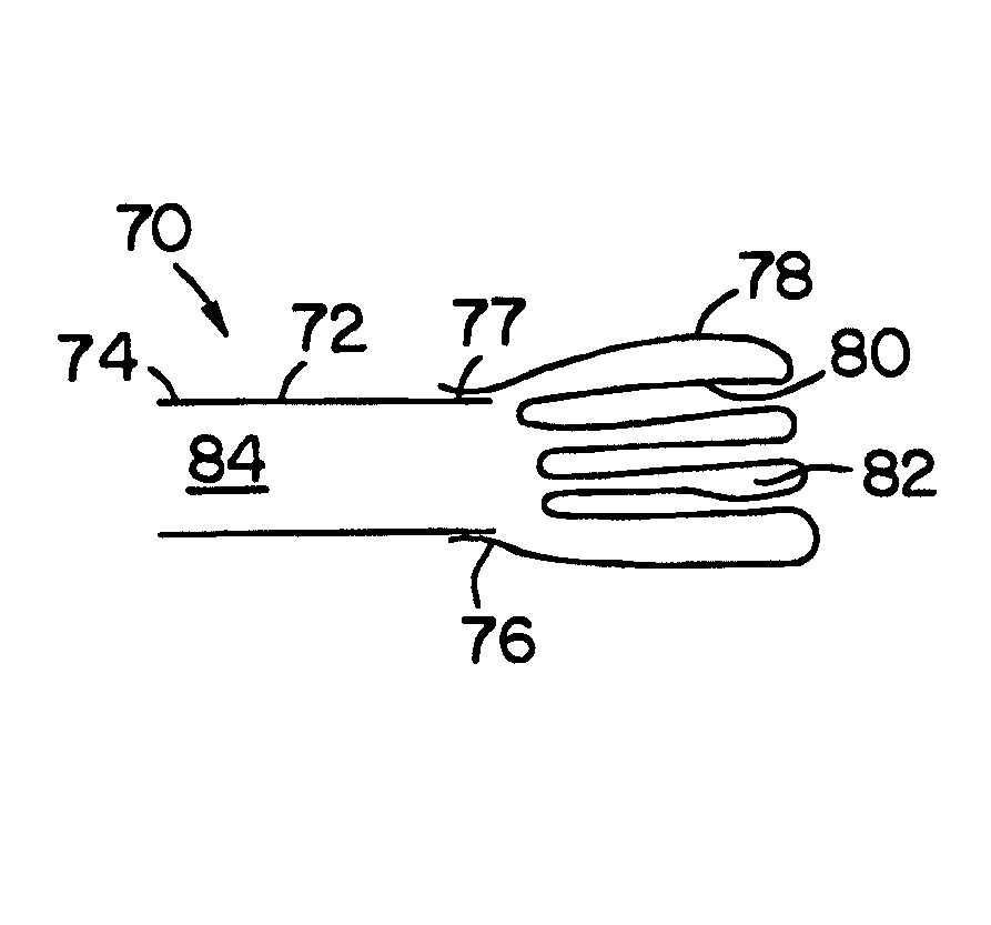 Endocardial dispersive electrode for use with a monopolar RF ablation pen