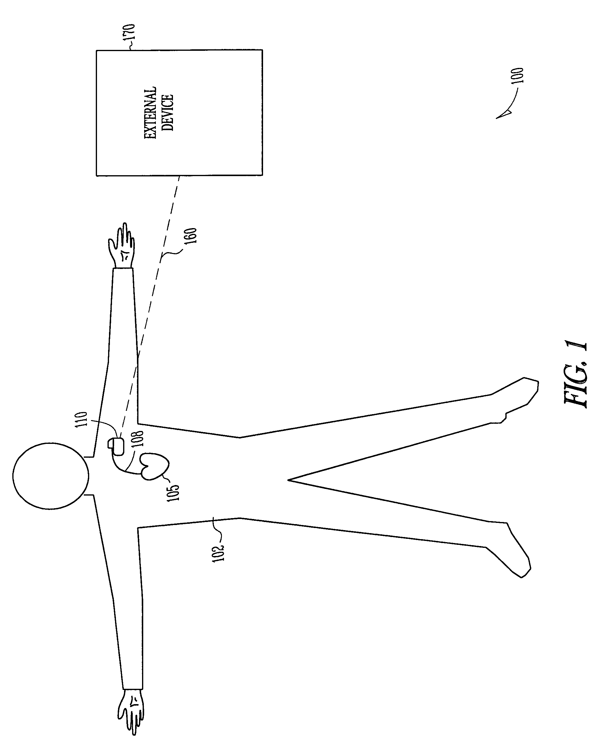 Hemodynamic stability assessment based on heart sounds