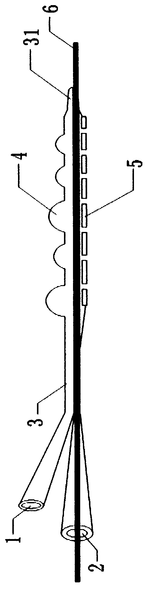 Iliofemoral deep venous thrombosis moniliform eccentric sacculus thrombolysis thrombectomy catheter and using method of same