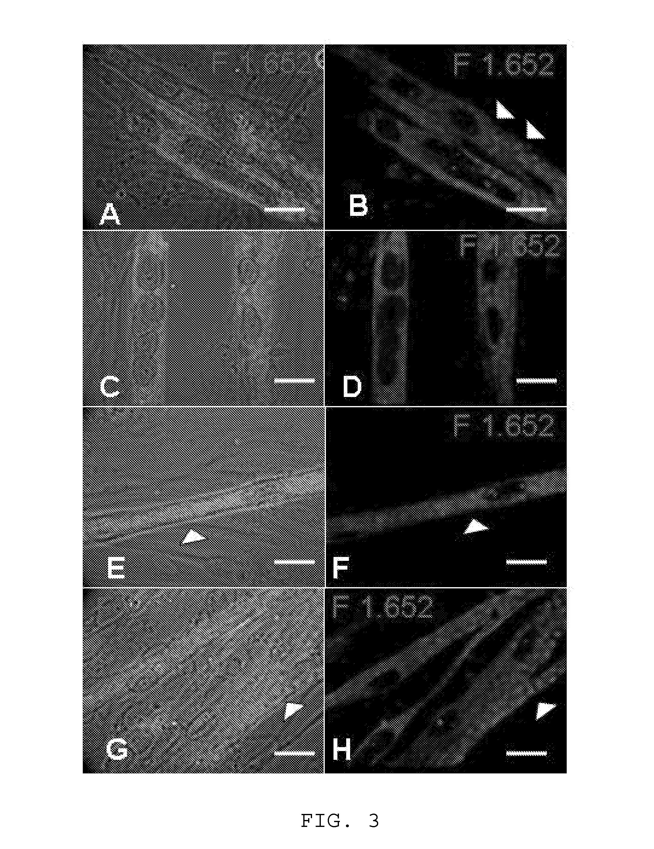 Method for culturing skeletal muscle for tissue engineering