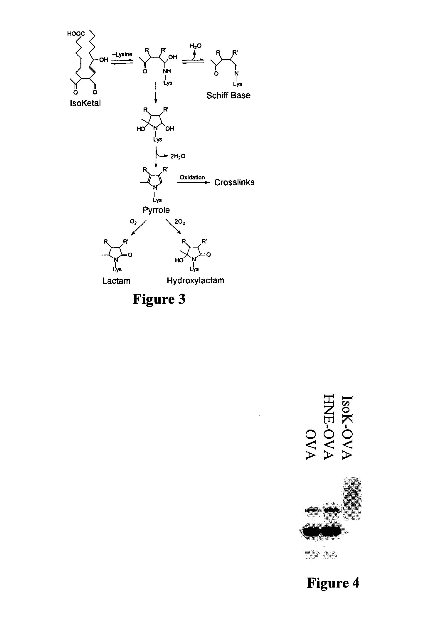 Method of preventing and/or treating oxidant injury in neurodegenerative and oxidative diseases