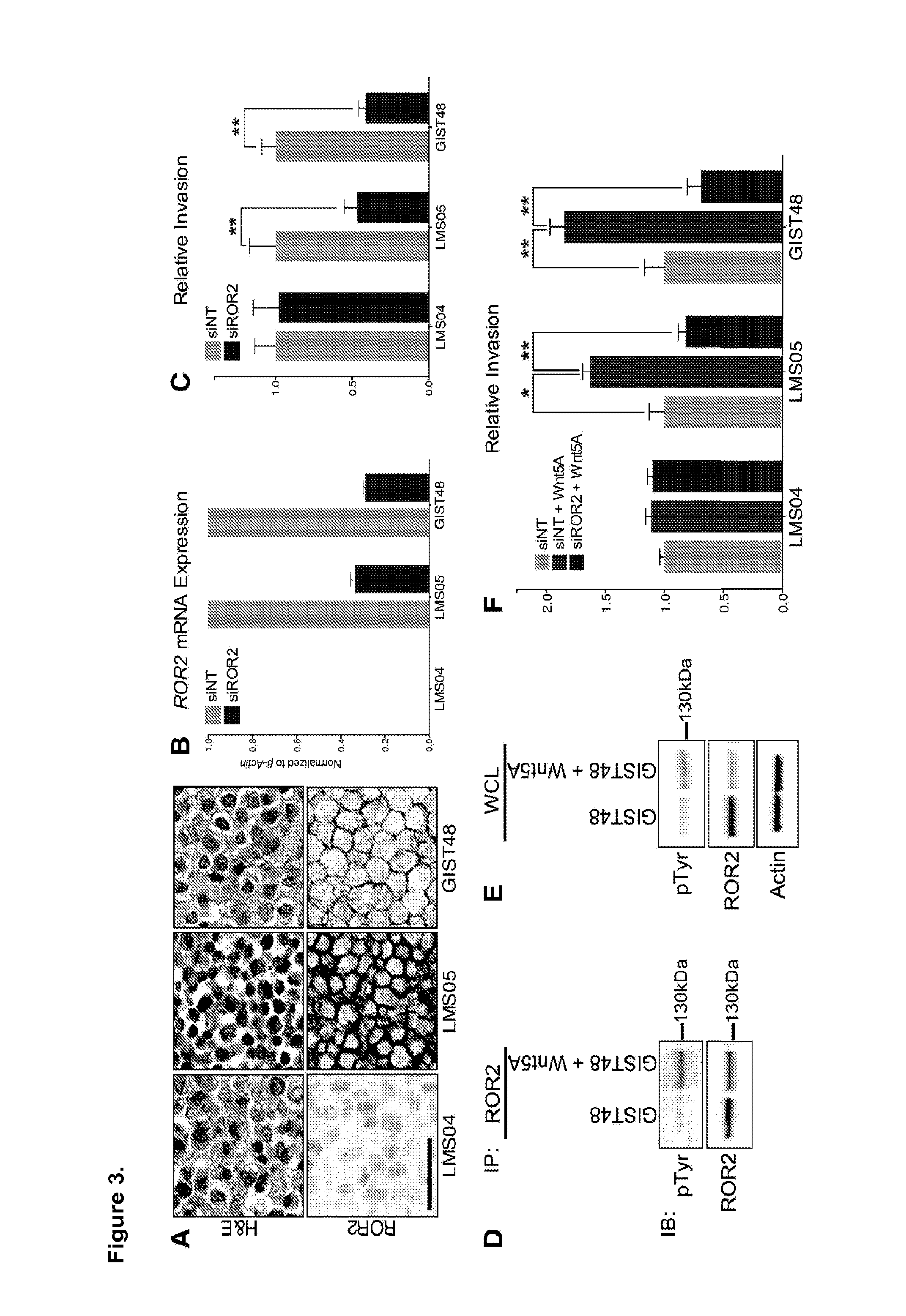 Analysis and Targeting of ROR2 in Cancer