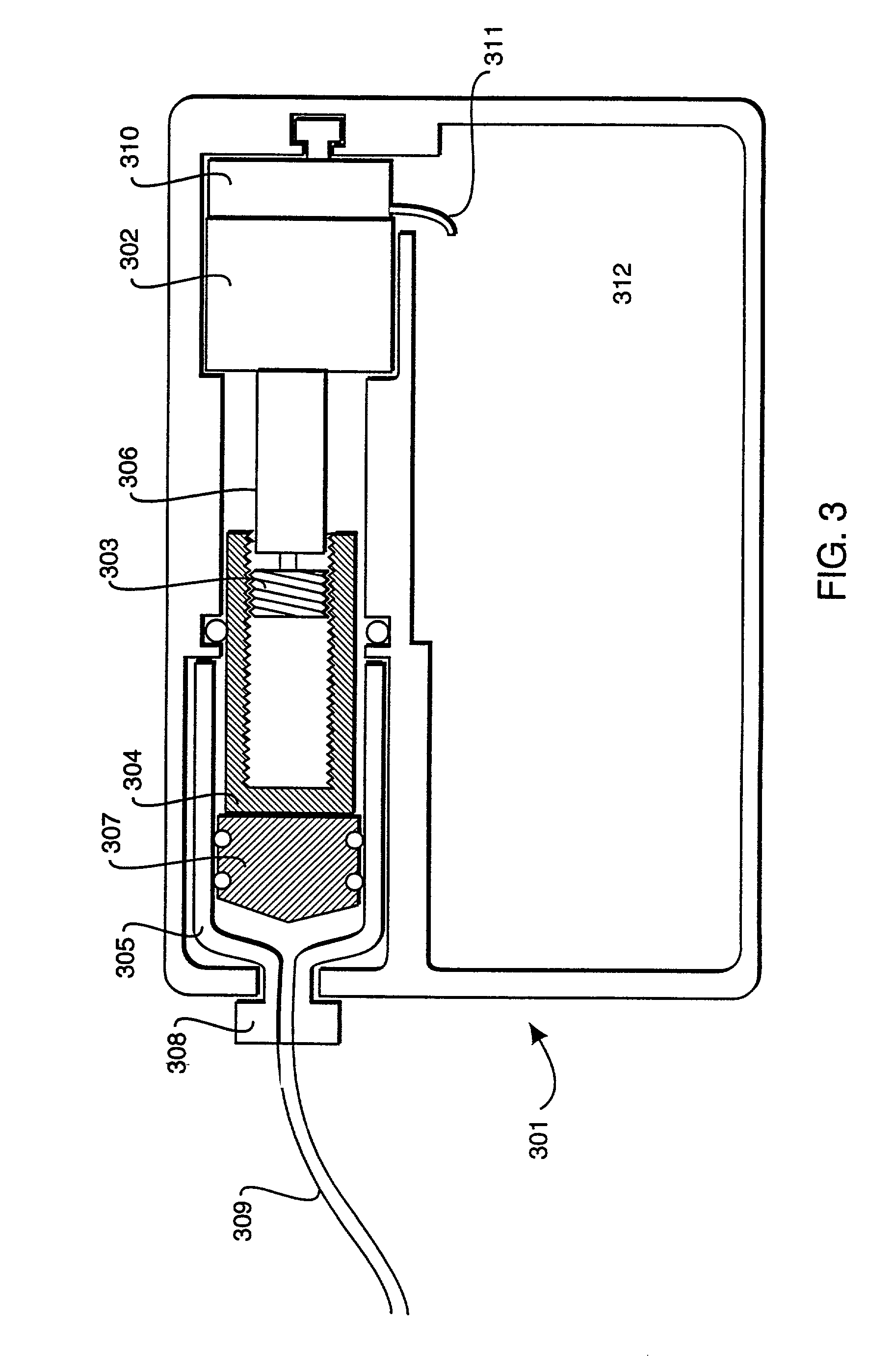 Method and apparatus for detection of occlusions