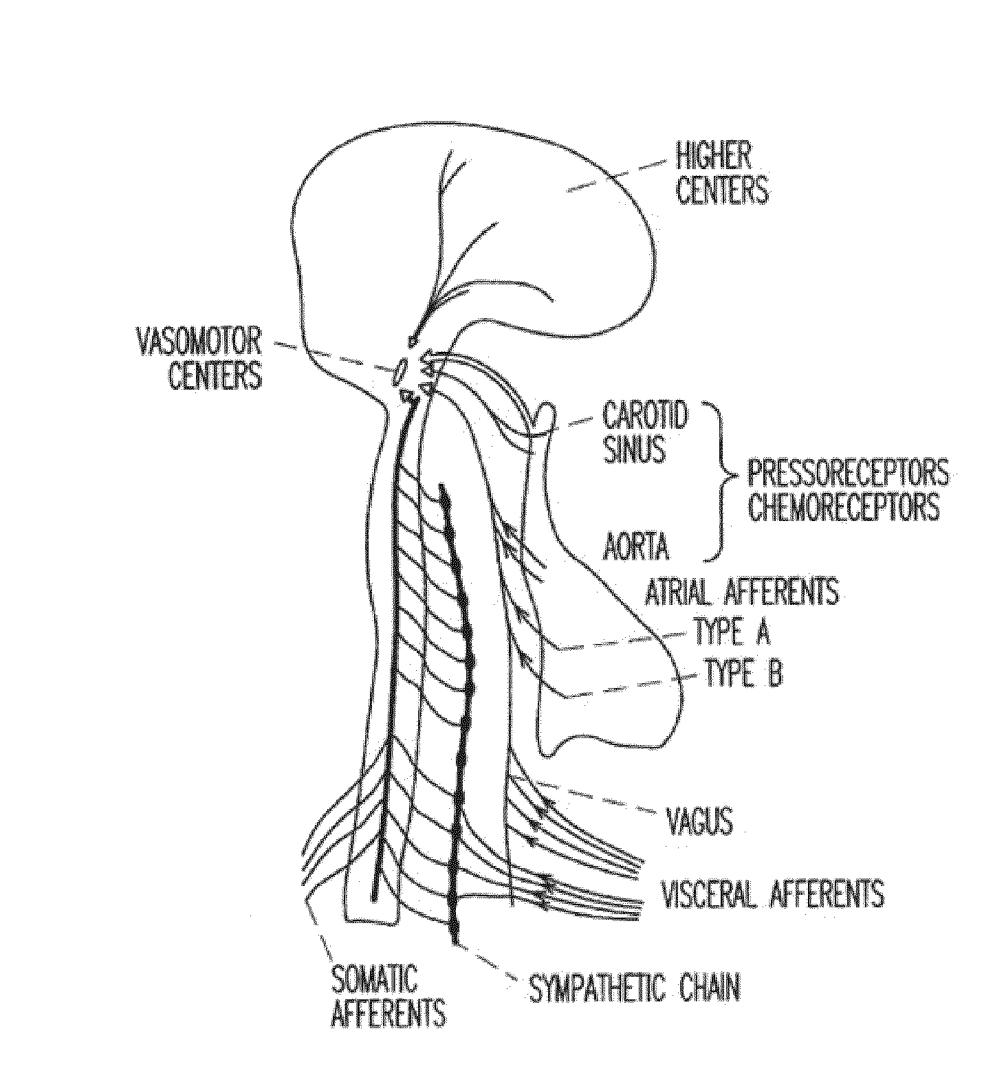 Adaptive baroreflex stimulation therapy for disordered breathing