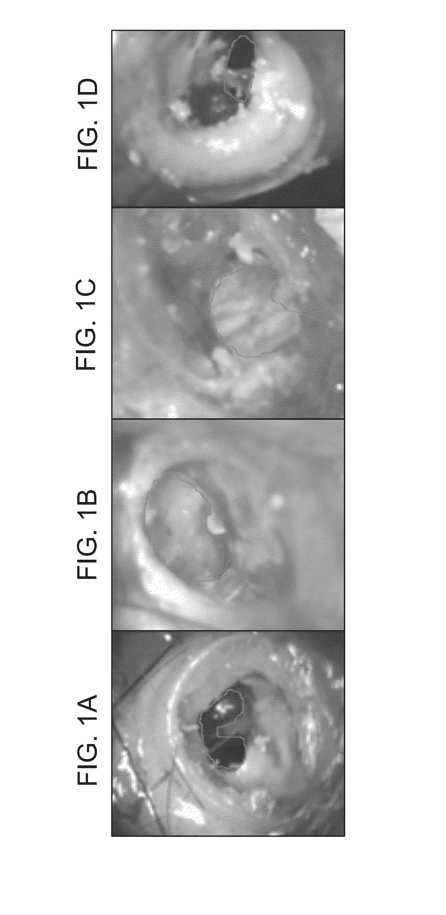 Modulation of Heparin-binding Epidermal Growth Factor Activity for Tympanic Membrane Healing