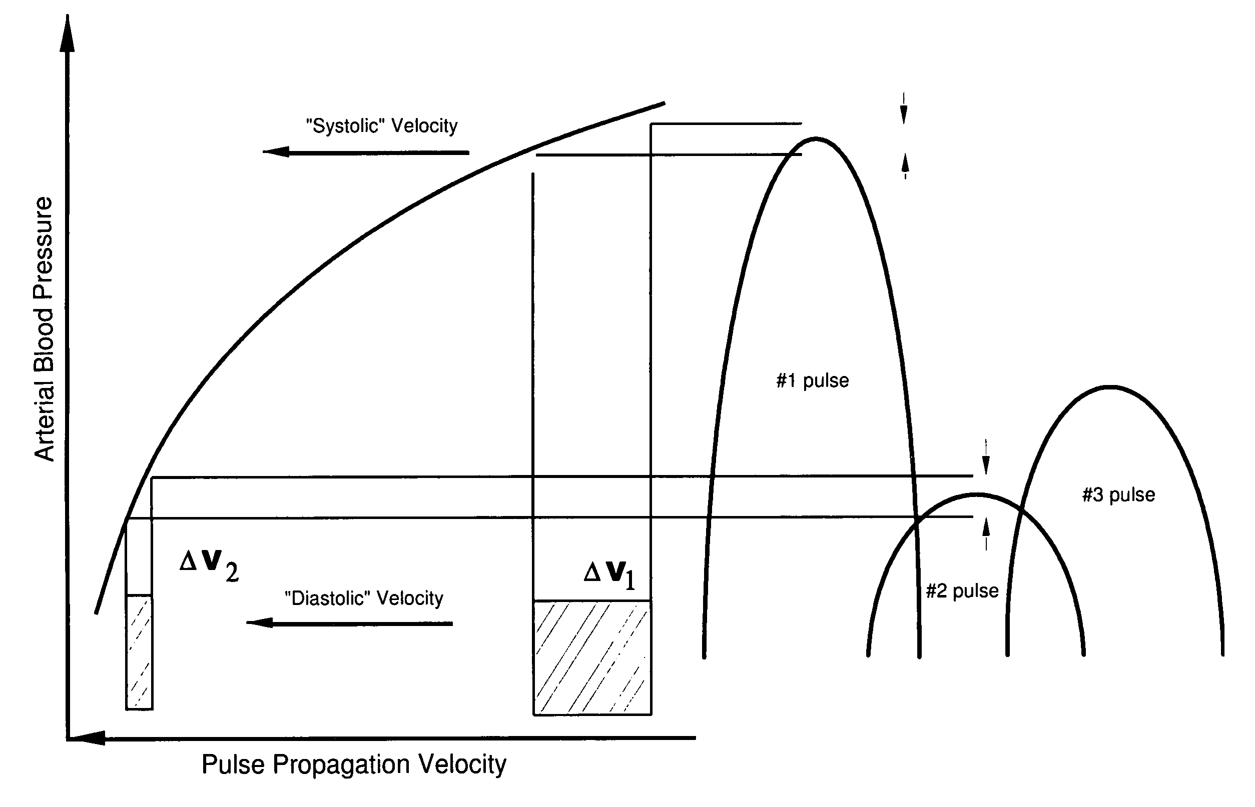 Arterial pulse decomposition analysis for vital signs determination