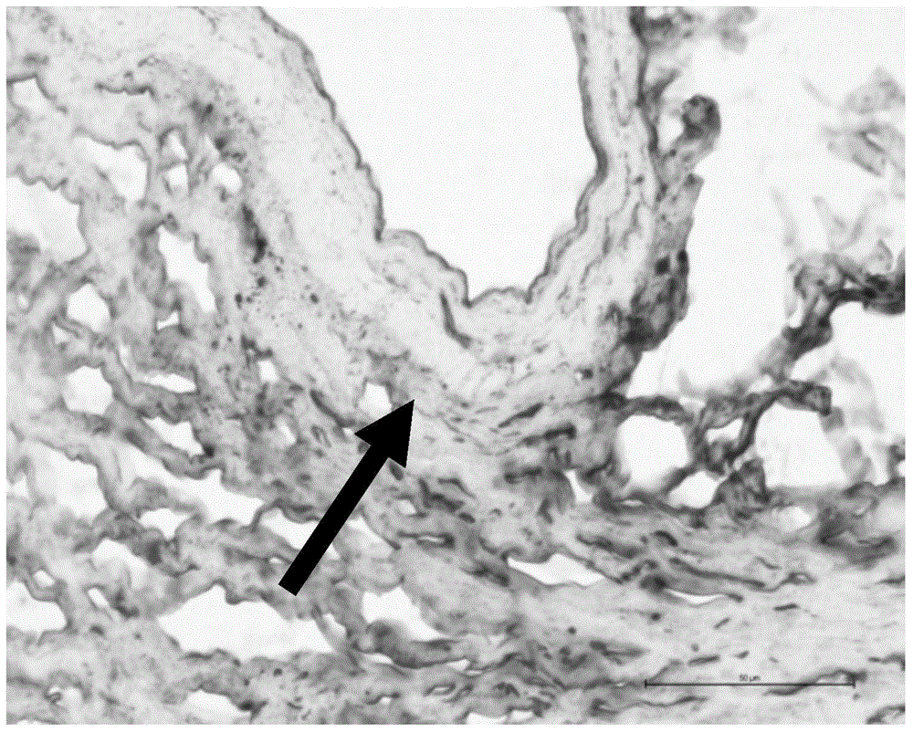 Eyedrop and preparation method thereof