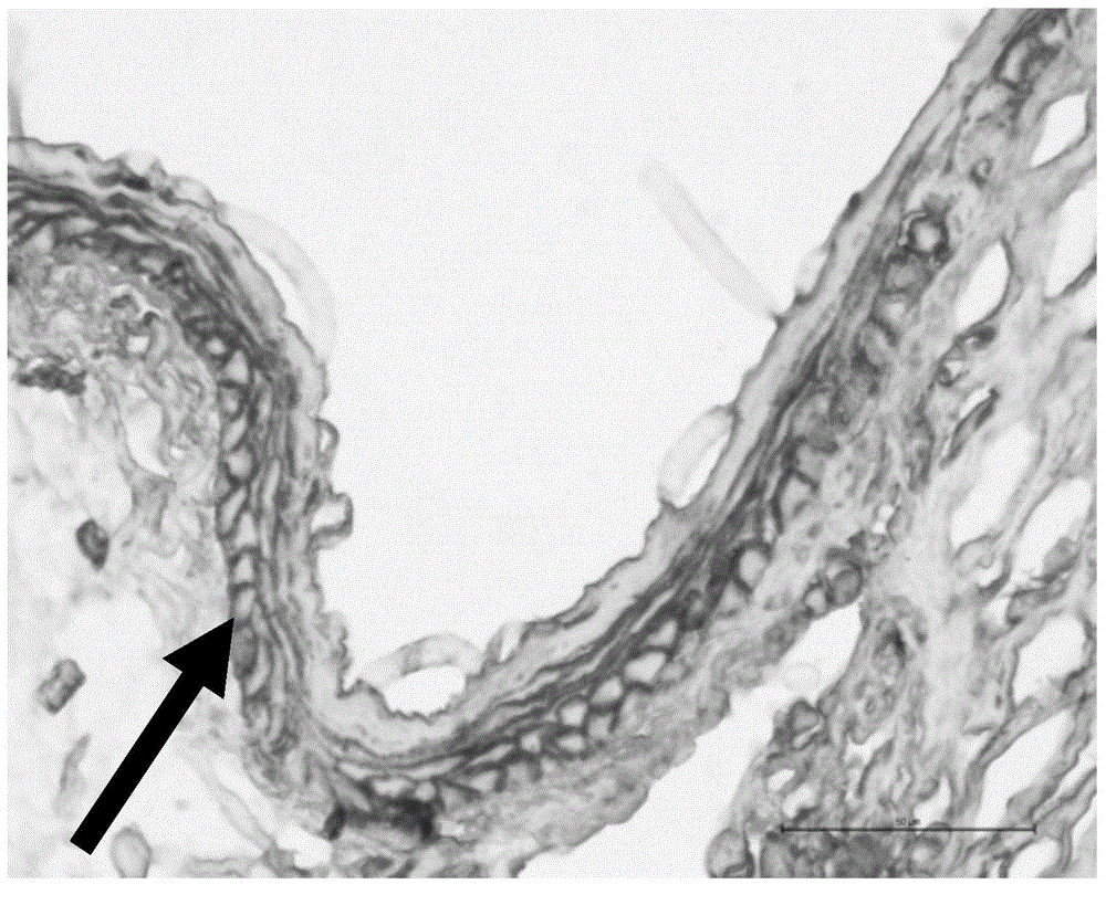 Eyedrop and preparation method thereof