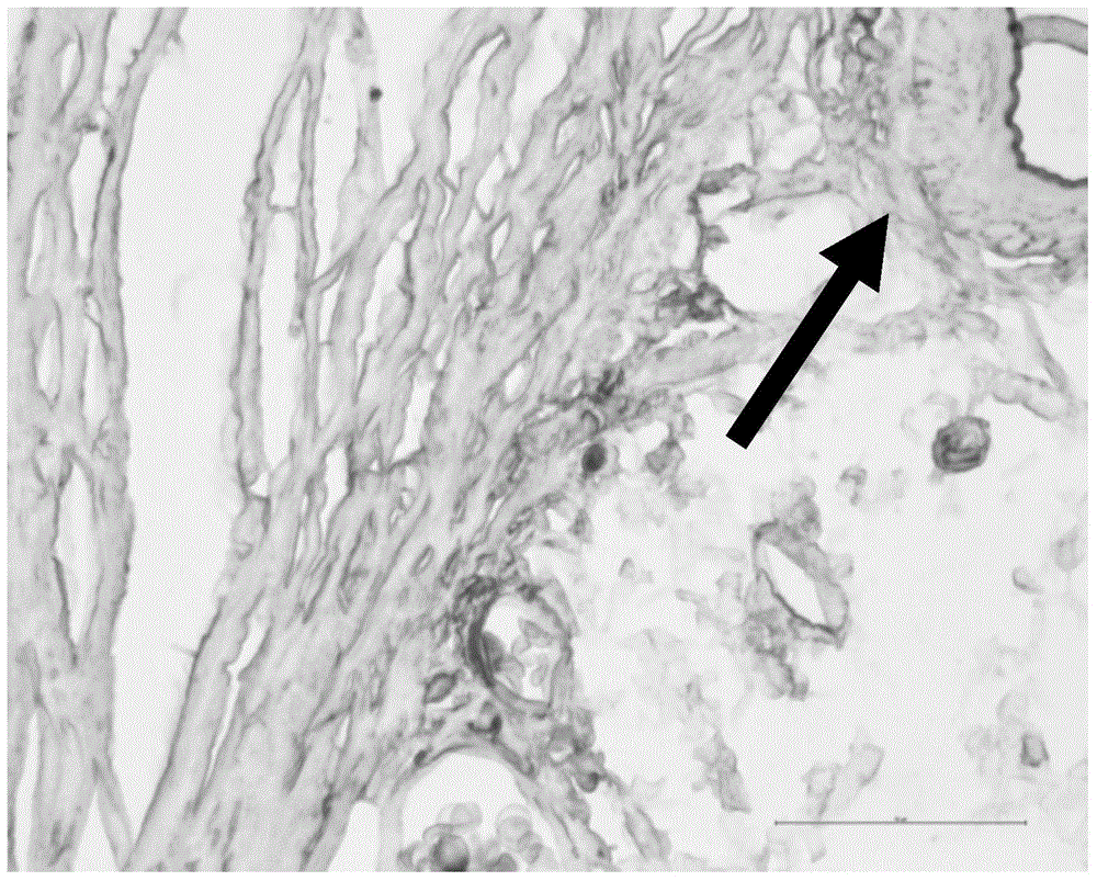 Eyedrop and preparation method thereof