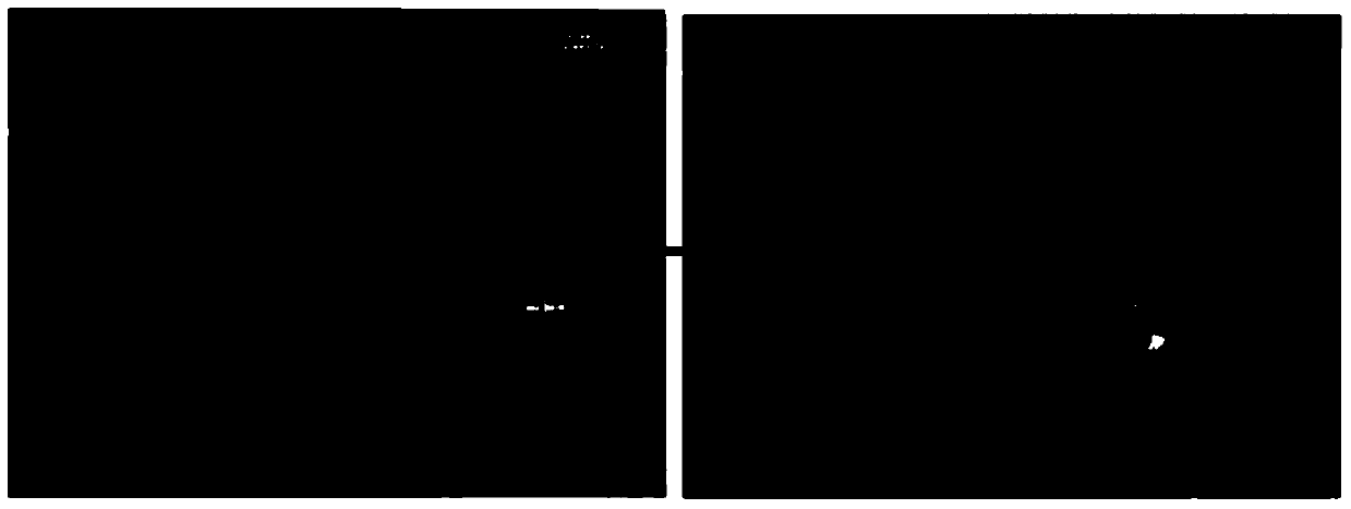 Skeletal muscle total-organ acellular matrix and preparation method and derivative medical products thereof