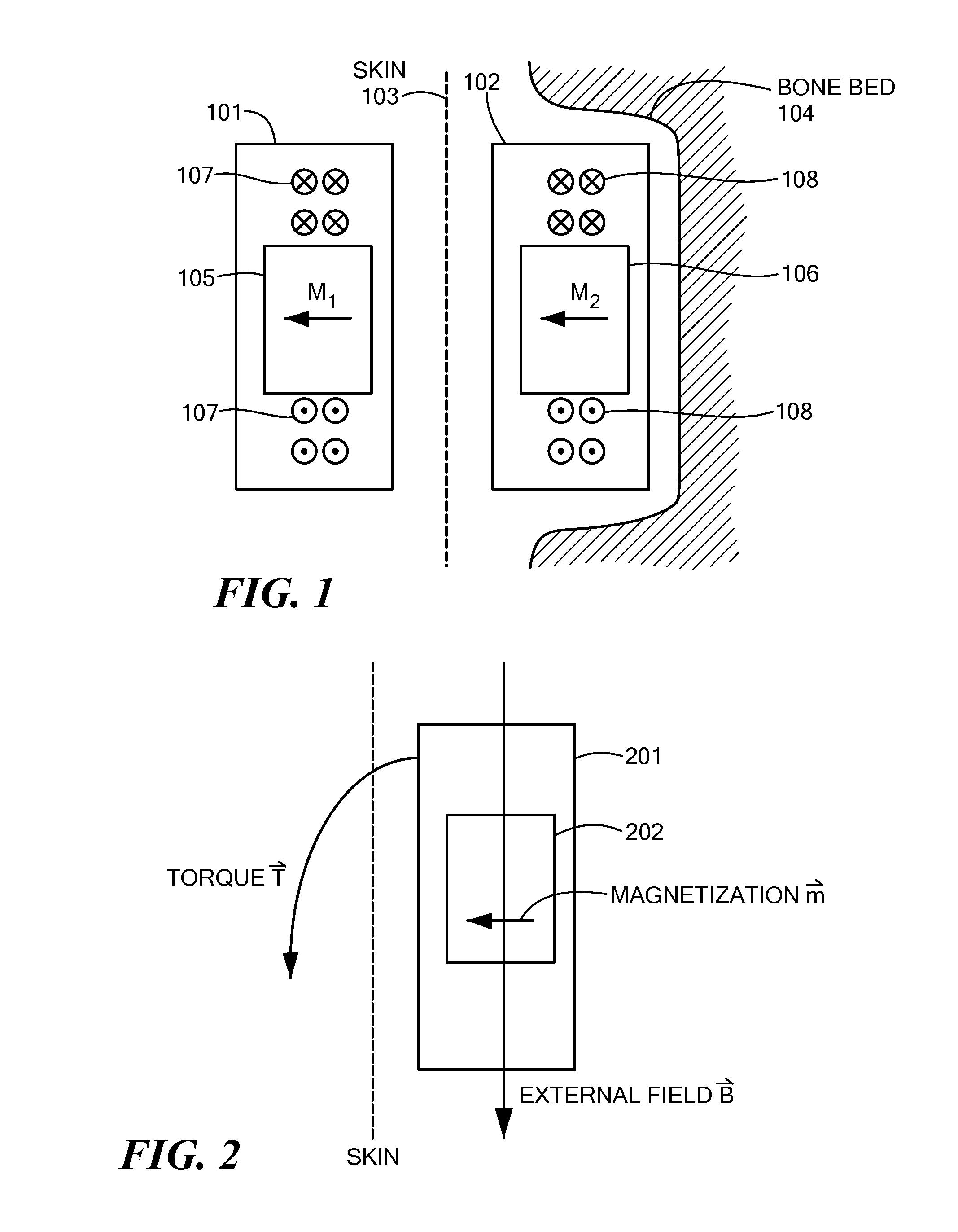 Magnetic Attachment Arrangement for Implantable Device