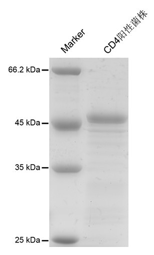 Human immunodeficiency virus affinity adsorption column, and preparation method and uses thereof