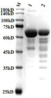 Compound composition containing recombinant collagen as well as preparation method and application of compound composition