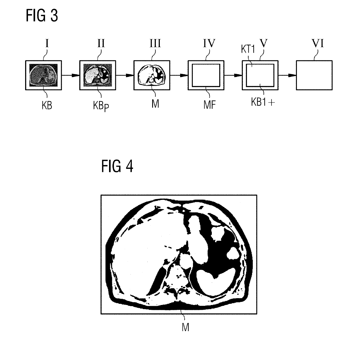 Method, computer and imaging apparatus