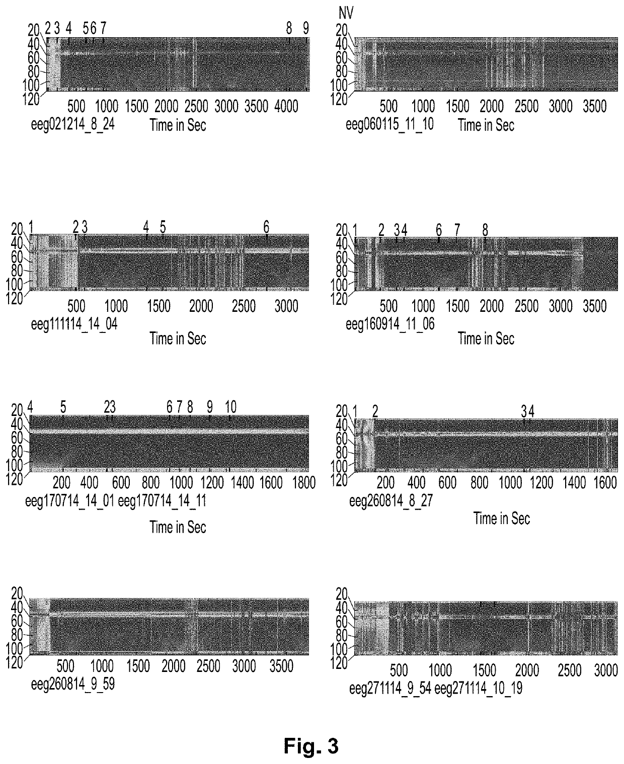 Systems and methods for analyzing brain activity and applications thereof