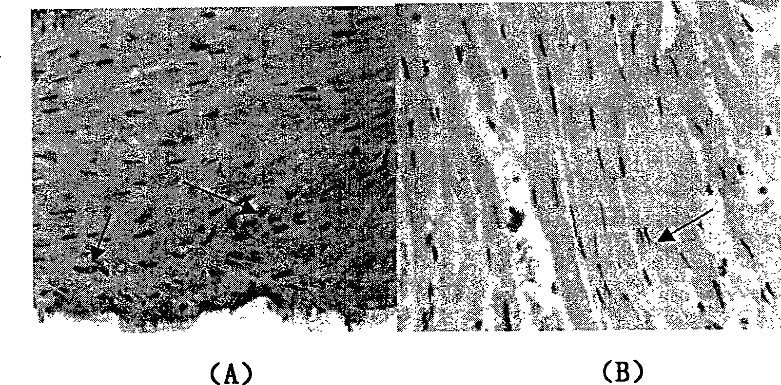 Coronary artery medicinal-coating stent