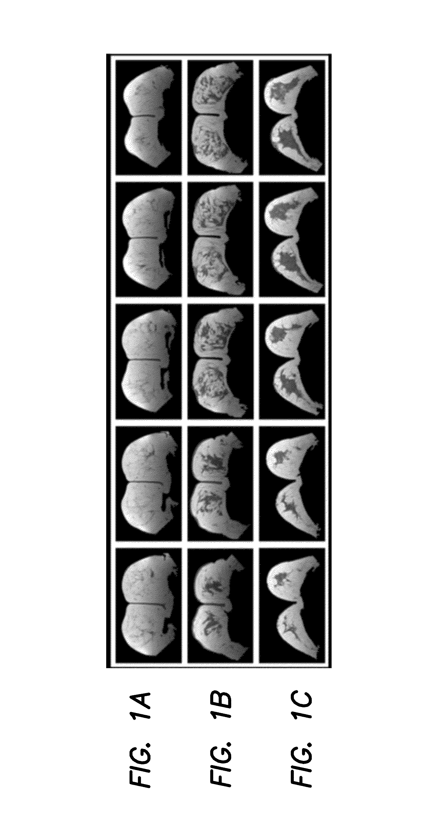 Method and apparatus for quantitative analysis of breast density morphology based on MRI