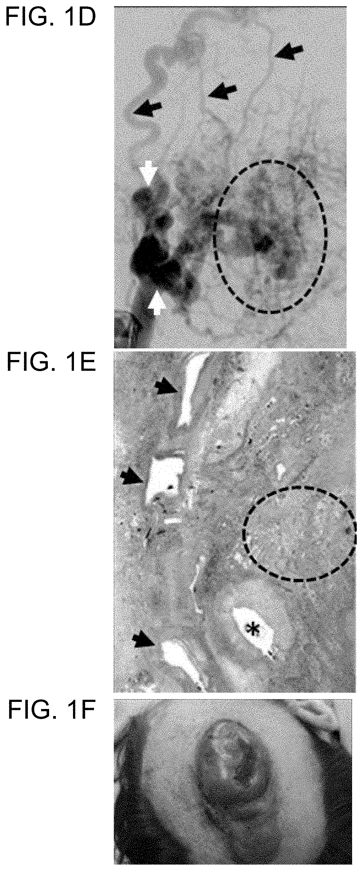 Map2k1 (MEK1) as a therapeutic target for arteriovenous malformations and associated disorders