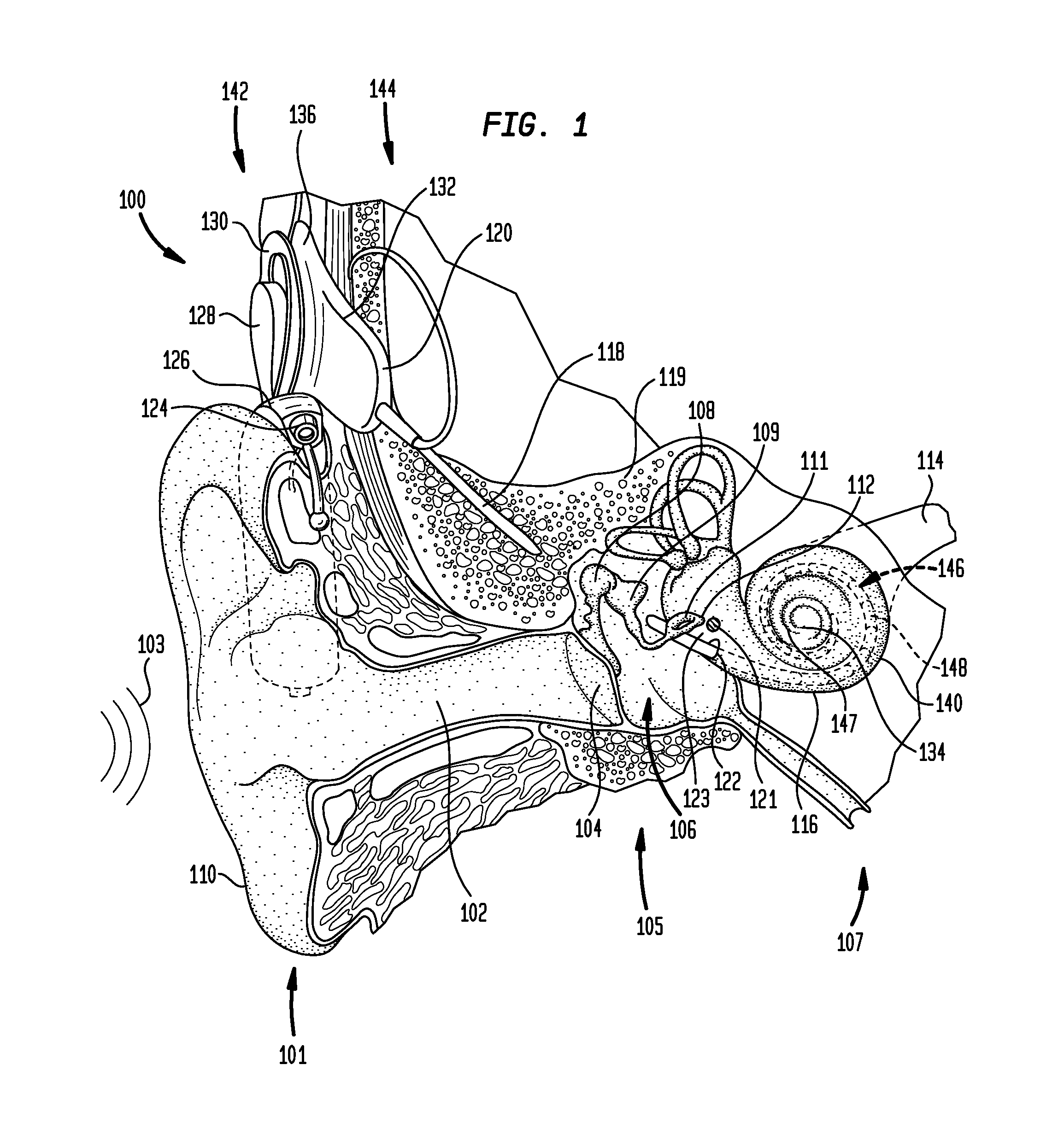 Synchronization in a bilateral auditory prosthesis system