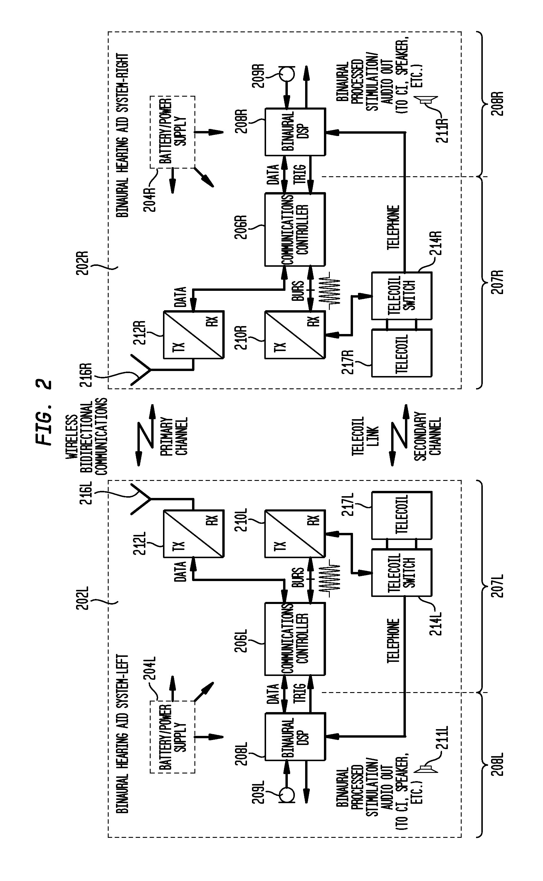 Synchronization in a bilateral auditory prosthesis system