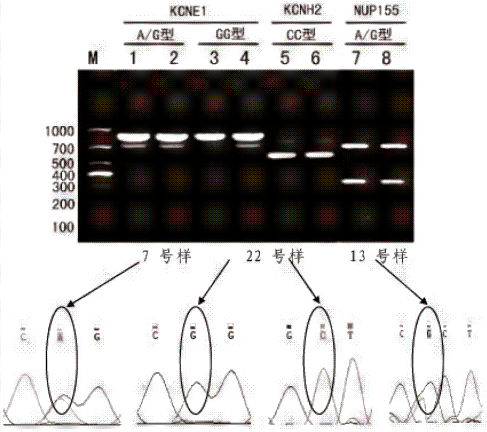 Rapid gene detection kit and rapid gene detection method for sudden cardiac death